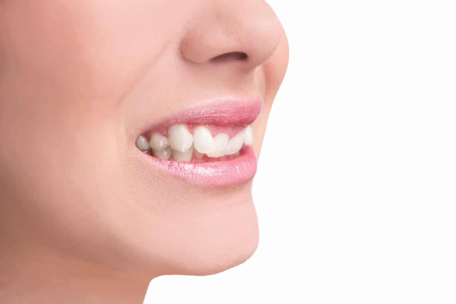 Close-up of a young woman smiling with a noticeable overbite